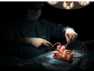 Advanced Heart Failure & Heart Transplantation